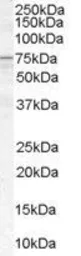 Anti-ACSL5 antibody, C-term used in Western Blot (WB). GTX89348