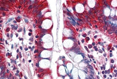 Anti-ACSL5 antibody, C-term used in IHC (Paraffin sections) (IHC-P). GTX89348