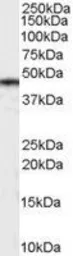 Anti-Casein Kinase 1 delta antibody, Internal used in Western Blot (WB). GTX89349