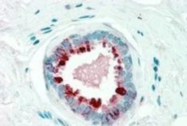 Anti-GCDFP15 antibody, Internal used in IHC (Paraffin sections) (IHC-P). GTX89351