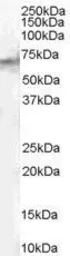 Anti-STAM2 antibody, Internal used in Western Blot (WB). GTX89357