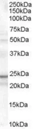 Anti-TIRAP antibody, Internal used in Western Blot (WB). GTX89359