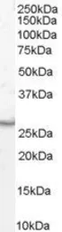 Anti-VTI1B antibody, Internal used in Western Blot (WB). GTX89361