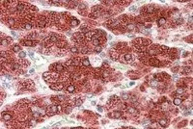 Anti-CYP17A1 antibody, Internal used in IHC (Paraffin sections) (IHC-P). GTX89365
