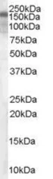 Anti-Hamartin / TSC1 antibody used in Western Blot (WB). GTX89366