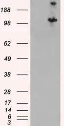 Anti-Hamartin / TSC1 antibody used in Western Blot (WB). GTX89366