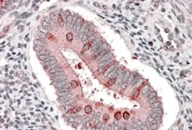 Anti-Hamartin / TSC1 antibody used in IHC (Paraffin sections) (IHC-P). GTX89366