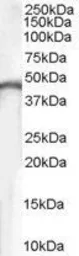 Anti-Creatine kinase (brain) antibody, Internal used in Western Blot (WB). GTX89370