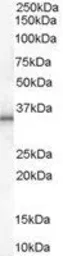 Anti-UCP1 antibody, C-term used in Western Blot (WB). GTX89371