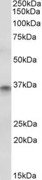 Anti-CDX2 antibody, Internal used in Western Blot (WB). GTX89372