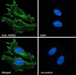 Anti-beta 1 Adrenergic Receptor antibody, Internal used in Immunocytochemistry/ Immunofluorescence (ICC/IF). GTX89376