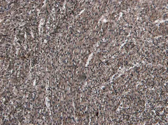 Anti-beta 1 Adrenergic Receptor antibody, Internal used in IHC (Paraffin sections) (IHC-P). GTX89376