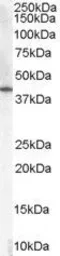 Anti-HSD3B1 antibody, C-term used in Western Blot (WB). GTX89377
