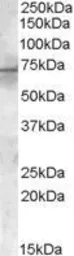Anti-Pyruvate dehydrogenase kinase 1 / PDK1 antibody, Internal used in Western Blot (WB). GTX89378