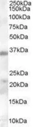 Anti-TIM-3 antibody, Internal used in Western Blot (WB). GTX89379