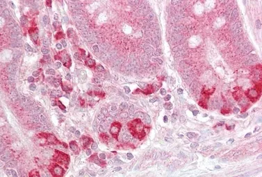 Anti-TRAF1 antibody, C-term used in IHC (Paraffin sections) (IHC-P). GTX89381