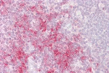 Anti-TRAF1 antibody, C-term used in IHC (Paraffin sections) (IHC-P). GTX89381