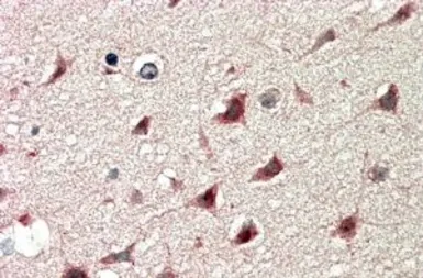 Anti-DCDC2 antibody, Internal used in IHC (Paraffin sections) (IHC-P). GTX89389