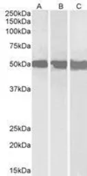 Anti-DDX6 antibody, C-term used in Western Blot (WB). GTX89391
