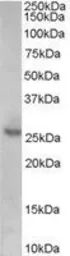 Anti-p27 Kip1 antibody, Internal used in Western Blot (WB). GTX89392