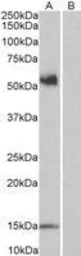 Anti-CD14 antibody, Internal used in Western Blot (WB). GTX89394