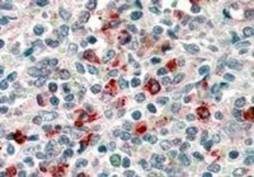 Anti-CD14 antibody, Internal used in IHC (Paraffin sections) (IHC-P). GTX89394