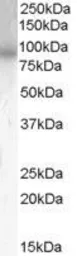 Anti-PDE4B antibody, C-term used in Western Blot (WB). GTX89403