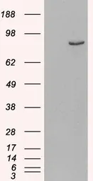Anti-PDE4B antibody, C-term used in Western Blot (WB). GTX89403