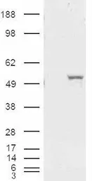 Anti-ALDH1A1 antibody, Internal used in Western Blot (WB). GTX89404