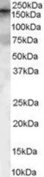 Anti-ARHGEF5 antibody, Internal used in Western Blot (WB). GTX89412