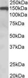Anti-OMG antibody, Internal used in Western Blot (WB). GTX89414