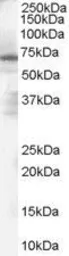 Anti-PARP2 antibody, Internal used in Western Blot (WB). GTX89417