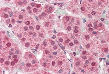 Anti-PARP2 antibody, Internal used in IHC (Paraffin sections) (IHC-P). GTX89417