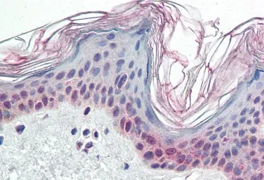Anti-PARP2 antibody, Internal used in IHC (Paraffin sections) (IHC-P). GTX89417