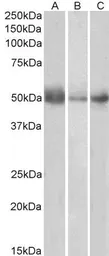 Anti-IDO1 antibody, Internal used in Western Blot (WB). GTX89419
