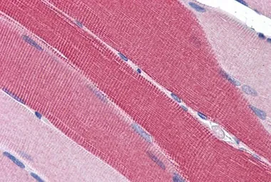 Anti-PDE4D antibody, C-term used in IHC (Paraffin sections) (IHC-P). GTX89423