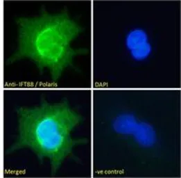 Anti-IFT88 antibody, C-term used in Immunocytochemistry/ Immunofluorescence (ICC/IF). GTX89425