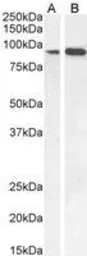 Anti-IFT88 antibody, C-term used in Western Blot (WB). GTX89425