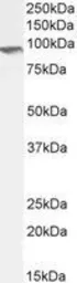 Anti-IFT88 antibody, C-term used in Western Blot (WB). GTX89425