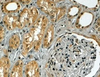 Anti-TRIM5 (alpha isoform) antibody, Internal used in IHC (Paraffin sections) (IHC-P). GTX89426