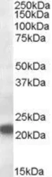 Anti-VPS25 antibody, Internal used in Western Blot (WB). GTX89428