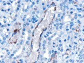 Anti-VPS25 antibody, Internal used in IHC (Paraffin sections) (IHC-P). GTX89428