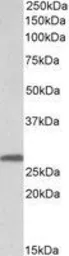 Anti-14-3-3 sigma antibody, Internal used in Western Blot (WB). GTX89431