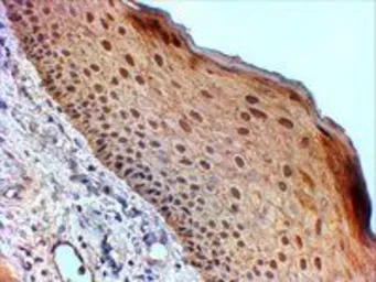 Anti-14-3-3 sigma antibody, Internal used in IHC (Paraffin sections) (IHC-P). GTX89431