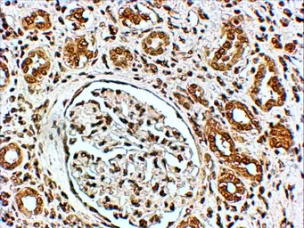 Anti-VPS41 antibody, Internal used in IHC (Paraffin sections) (IHC-P). GTX89439