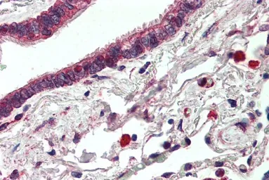 Anti-Her3 / ErbB3 antibody, C-term used in IHC (Paraffin sections) (IHC-P). GTX89440