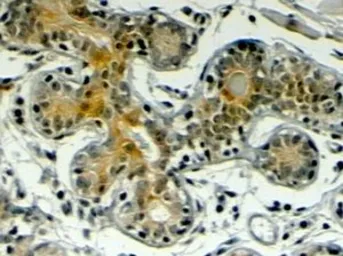Anti-Klotho antibody, Internal used in IHC (Paraffin sections) (IHC-P). GTX89443