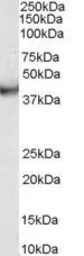 Anti-VPS37C antibody, Internal used in Western Blot (WB). GTX89444