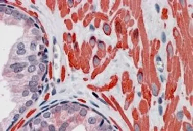 Anti-VPS37C antibody, Internal used in IHC (Paraffin sections) (IHC-P). GTX89444
