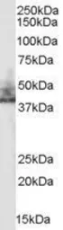 Anti-NHERF2 (isoform a) antibody, Internal used in Western Blot (WB). GTX89452